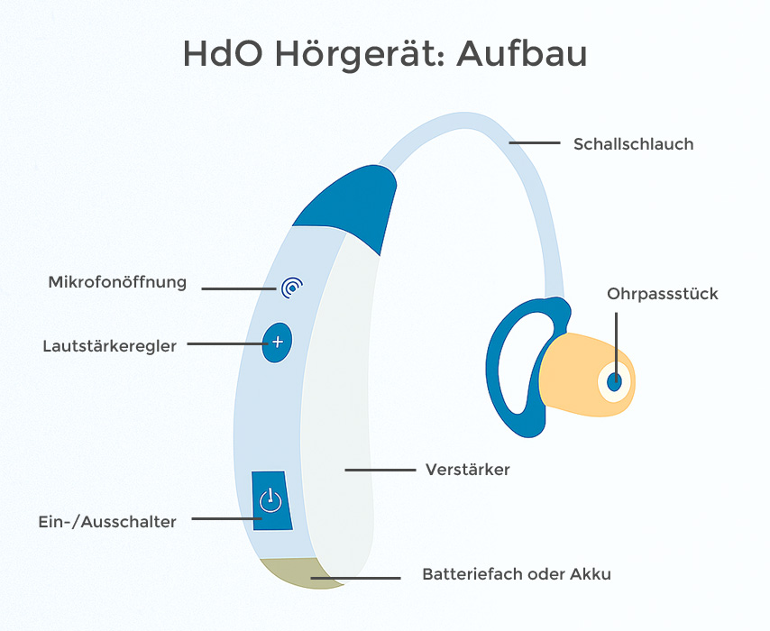 HdO Hörgerät Aufbau Infografik