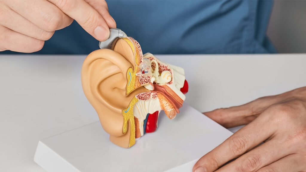 Zunehmender Hörverlust